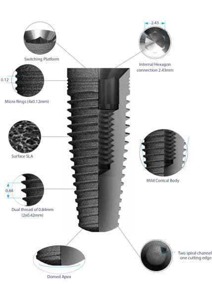 Eminence Dental Implant